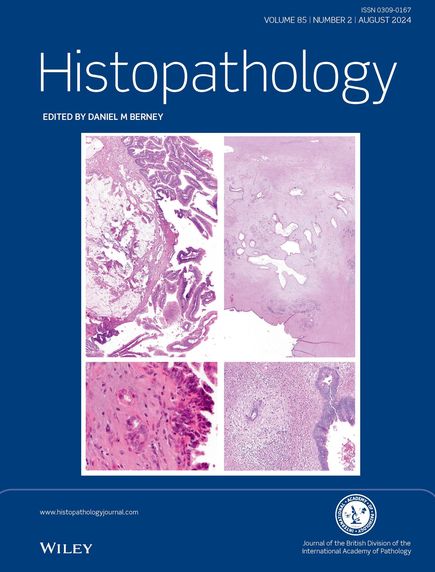 Histopathology Latest Journal Issues: Now Available image