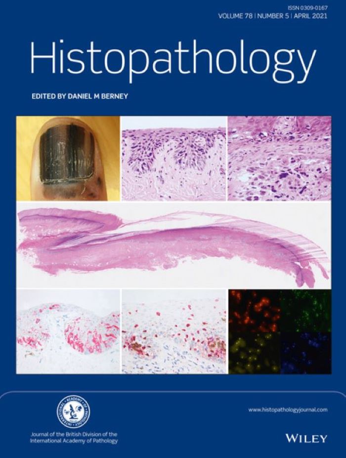 Histopathology Latest Journal Issue Now Available | BDIAP