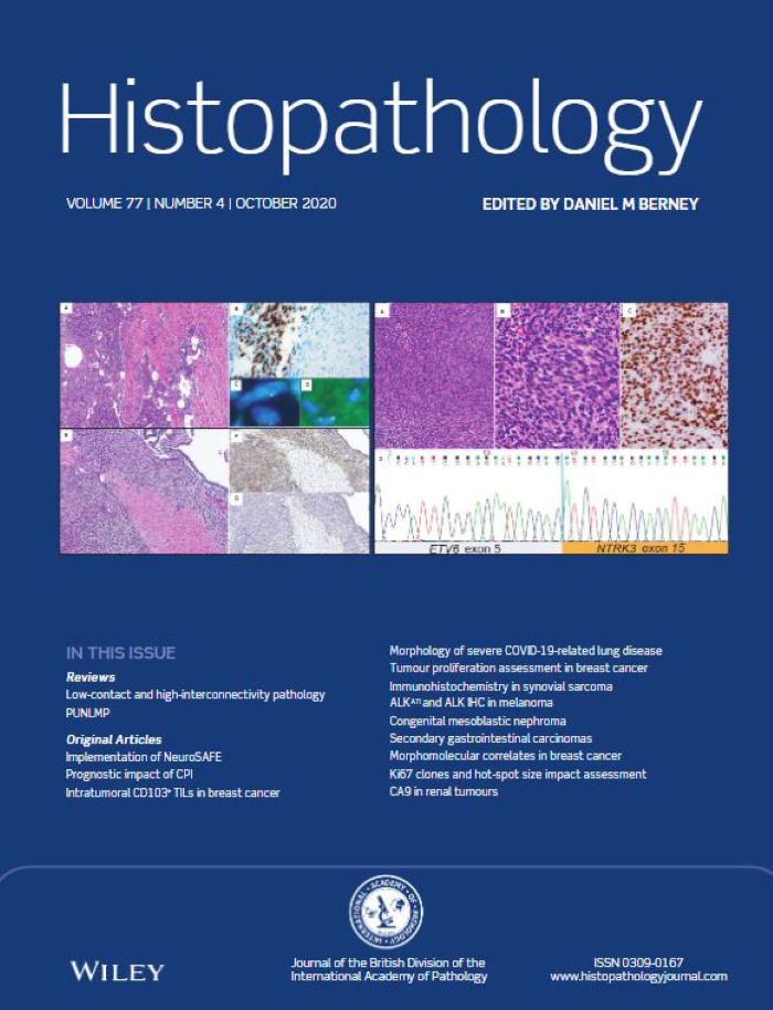 Histopathology Latest Journal Issue Now Available 