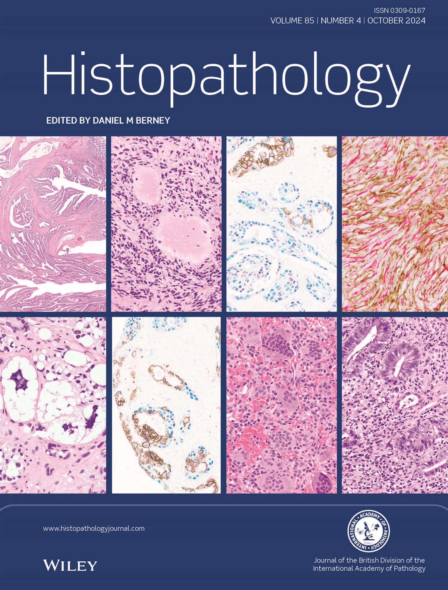 Histopathology Latest Journal Issue: Now Available image