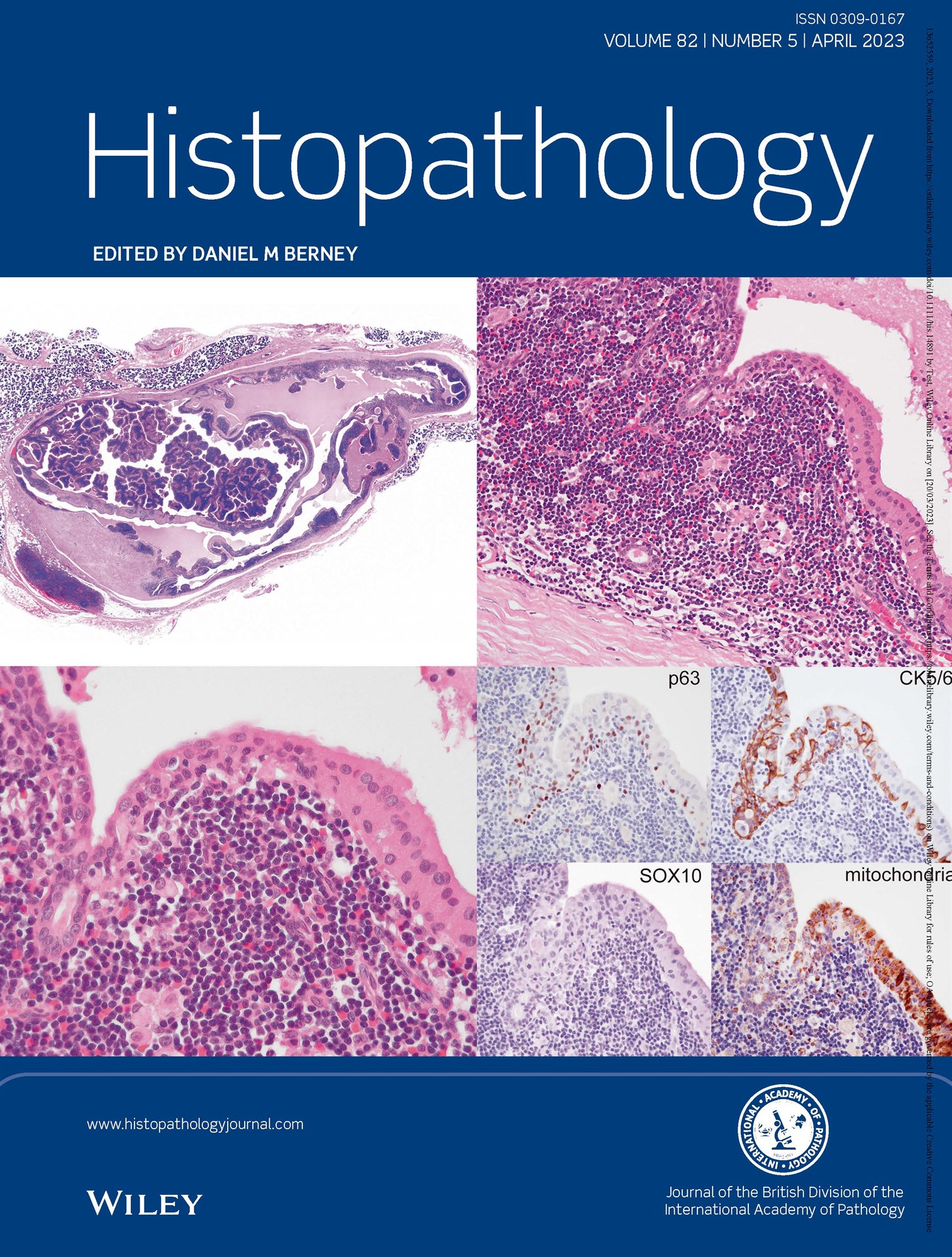 Histopathology Latest Journal Issue Now Available | BDIAP