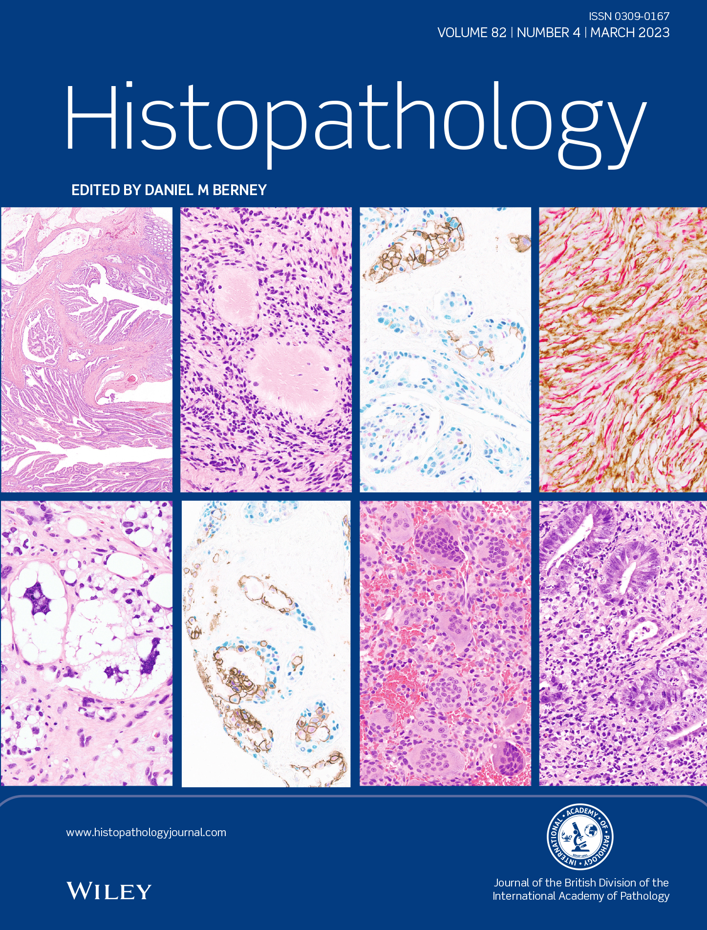 Histopathology Latest Journal Issue Now Available image