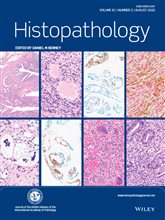 Histopathology Latest Journal Issue Now Available