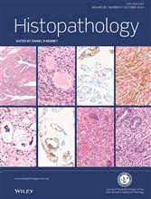 Histopathology Latest Journal Issue: Now Available