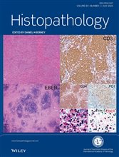 Histopathology Latest Journal Issue Now Available