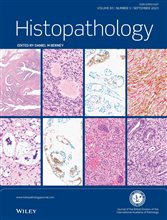 Histopathology Journal: Latest Issue Now Available