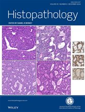 Histopathology Latest Journal Issue: Now Available