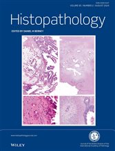 Histopathology Latest Journal Issues: Now Available